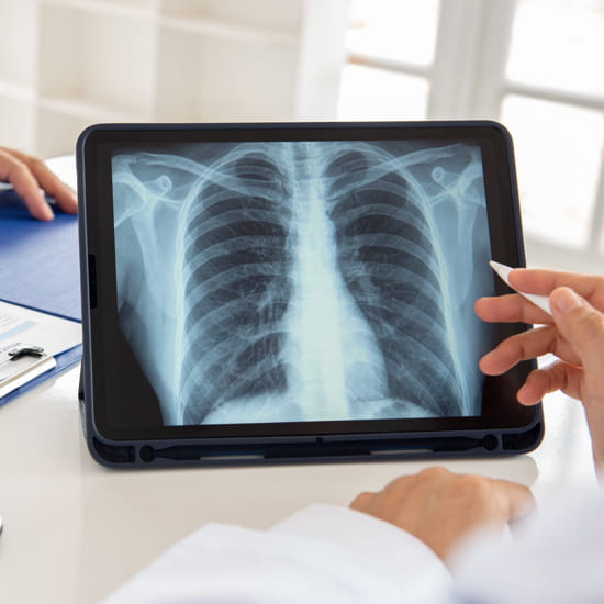 Computer tablet with lung scan