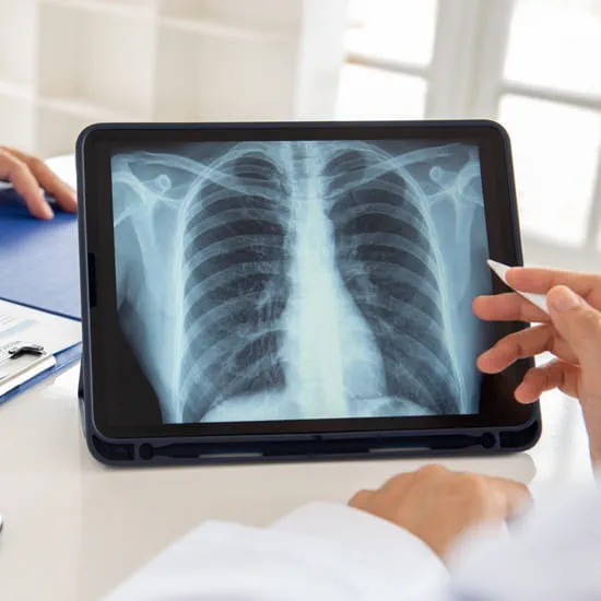 Computer tablet with lung scan