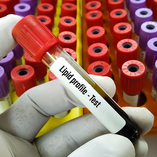 Frankly Speaking CME 8