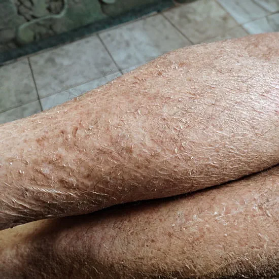older skin