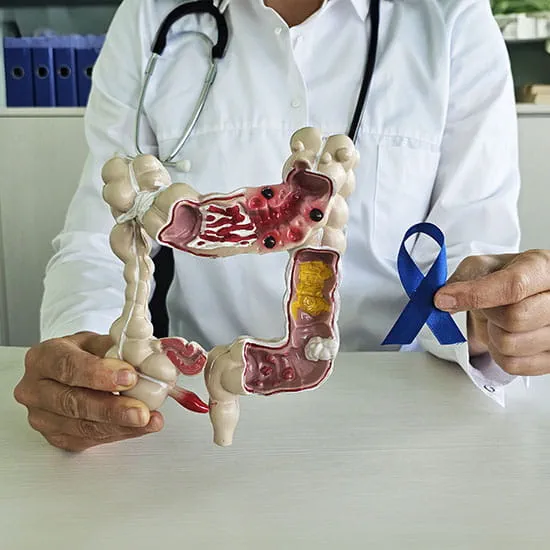 colorectal cancer