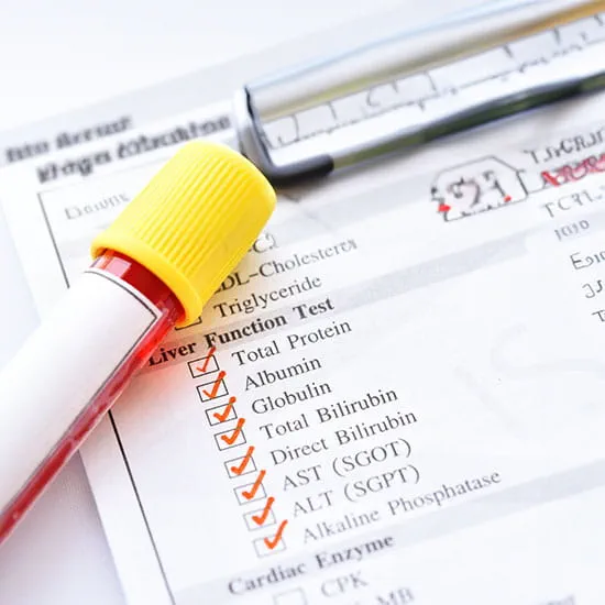 Blood sample for liver function test