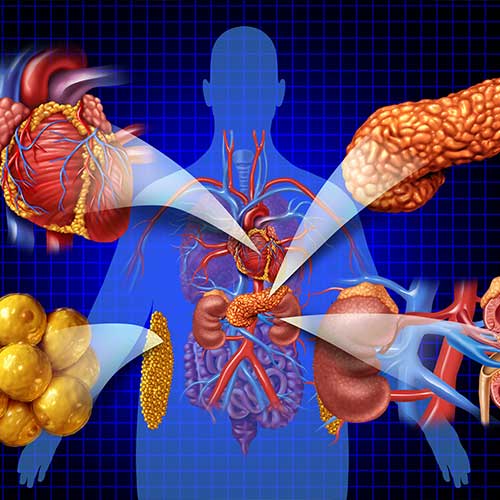 Cardiorenal metabolic syndrome or Cardiovascular kidney metabolic multisystem disorder as disease related to a group of organs as kidneys heart pancreas and Adipose cells.
