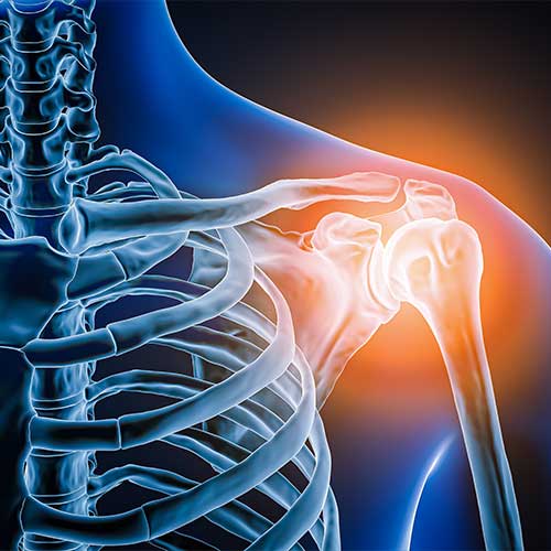 Anterior or front view of human shoulder joint and bones with inflammation 3D rendering illustration. Pathology, articular pain, anatomy, osteology, rheumatism, medical and healthcare concept.