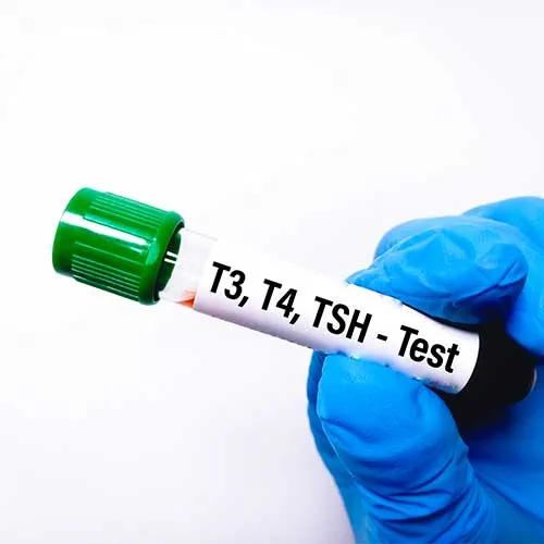 Blood sample in test tube for hormonal examination of thyroid gland in laboratory. T3, T4, TSH, diagnosis of hyperthyroidism or hypothyroidism of a patient. Isolated on a white background.