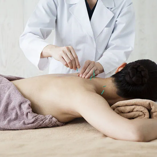 accupuncture on back