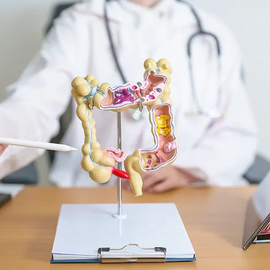 model of colon