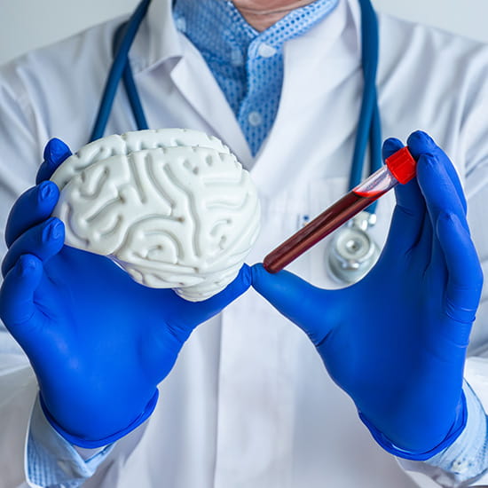 doctor holding brain model and blood vial