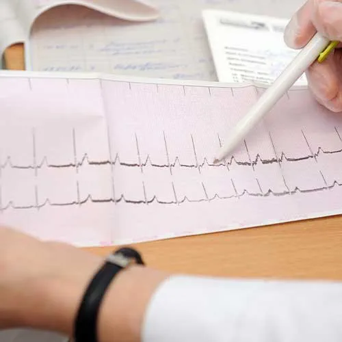 The doctor looks at the cardiogram of the heart on paper.