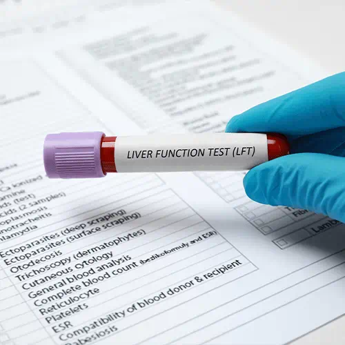 small vial labeled "Liver Function Tests"