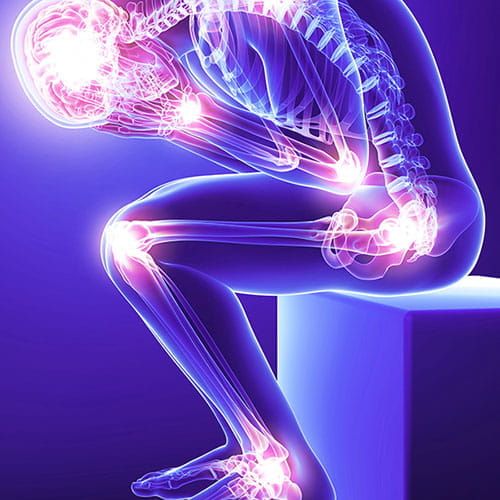 Illustration of a person sitting bent over with different pain spots shown