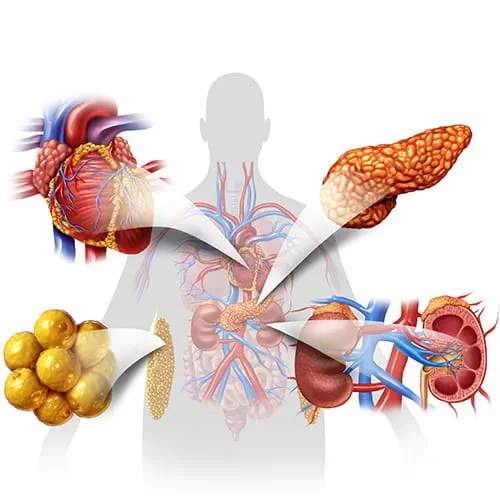 Medical illustration of cardiovascular-kidney-metabolic syndrome
