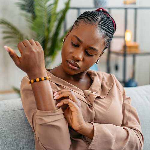 Young black woman having a rash (skin condition) while sitting on the sofa at home.