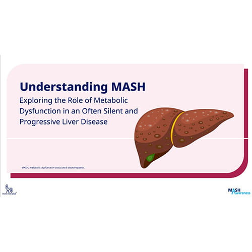 Medical illustration of MASH