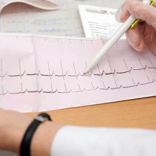 The doctor looks at the cardiogram of the heart on paper.