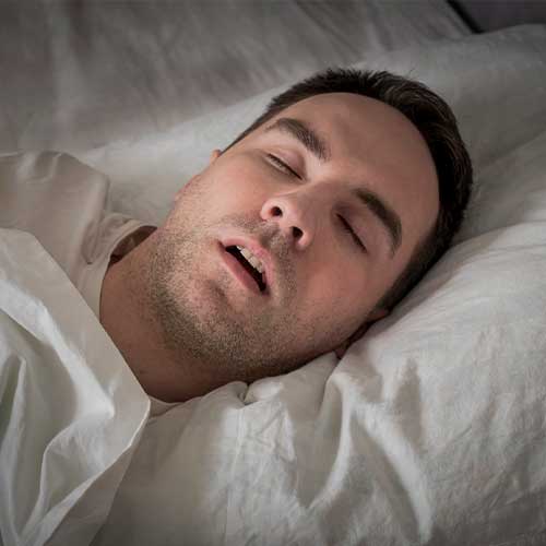 View Of Tired Young Man Snoring While Deep Sleeping In Bed. The problem of snoring during sleep. A young cute guy sleeps on a white bed at night