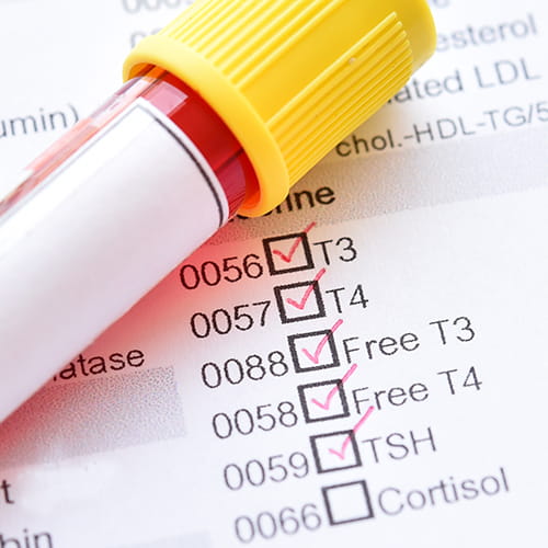 Blood sample tube on a lab form with thyroid tests (T3, T4, Free T3, Free T4, TSH) checked.