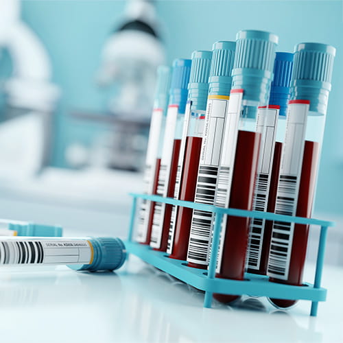 Image of blood tubes