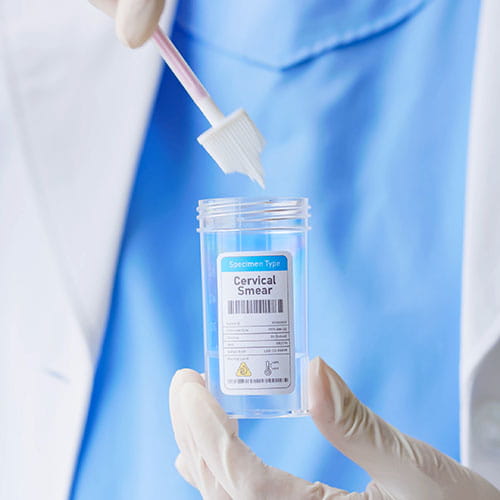 pap smear collection