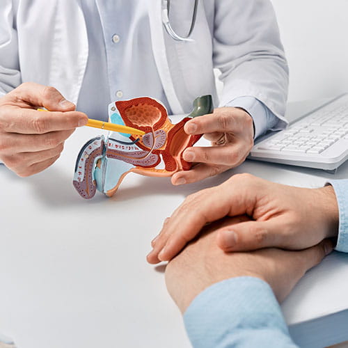 prostate cancer screening