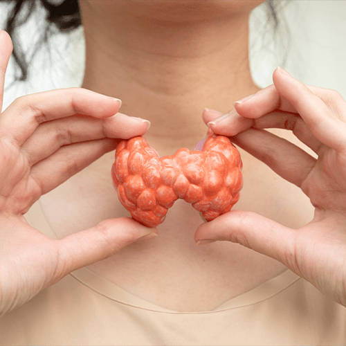 Hyperthyroidism, Overactive Thyroid, Thyroid Lymphoma, Asian woman with thyroid gland human anatomy model.