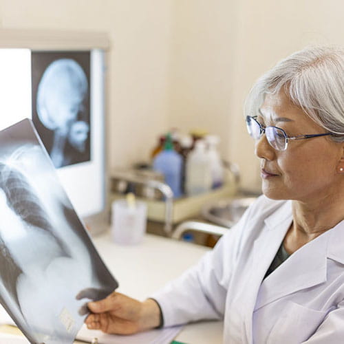 A doctor looking at an x-ray of the lungs.