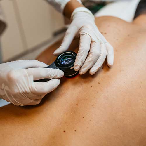 Female doctor examining patients birthmarks for skin cancer in a medical clinic.