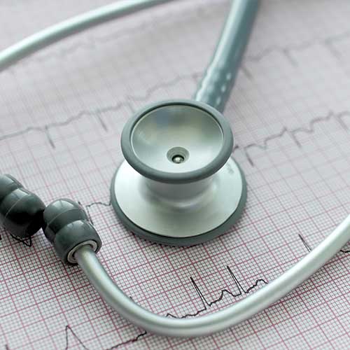 Stethoscope on the ECG. Symbolic close-up photo