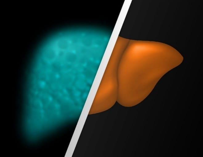 Split-panel medical imaging comparison showing a cyan/teal ultrasound scan of the liver on the left and a 3D rendered orange anatomical model of the liver on the right, set against a black background.