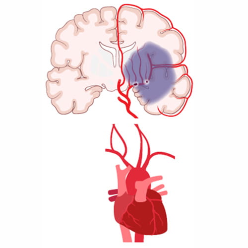 heart and brain