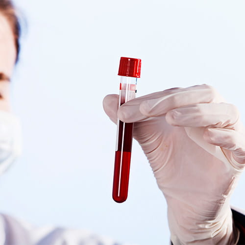 A masked healthcare professional in white gloves holding up a blood sample test tube.